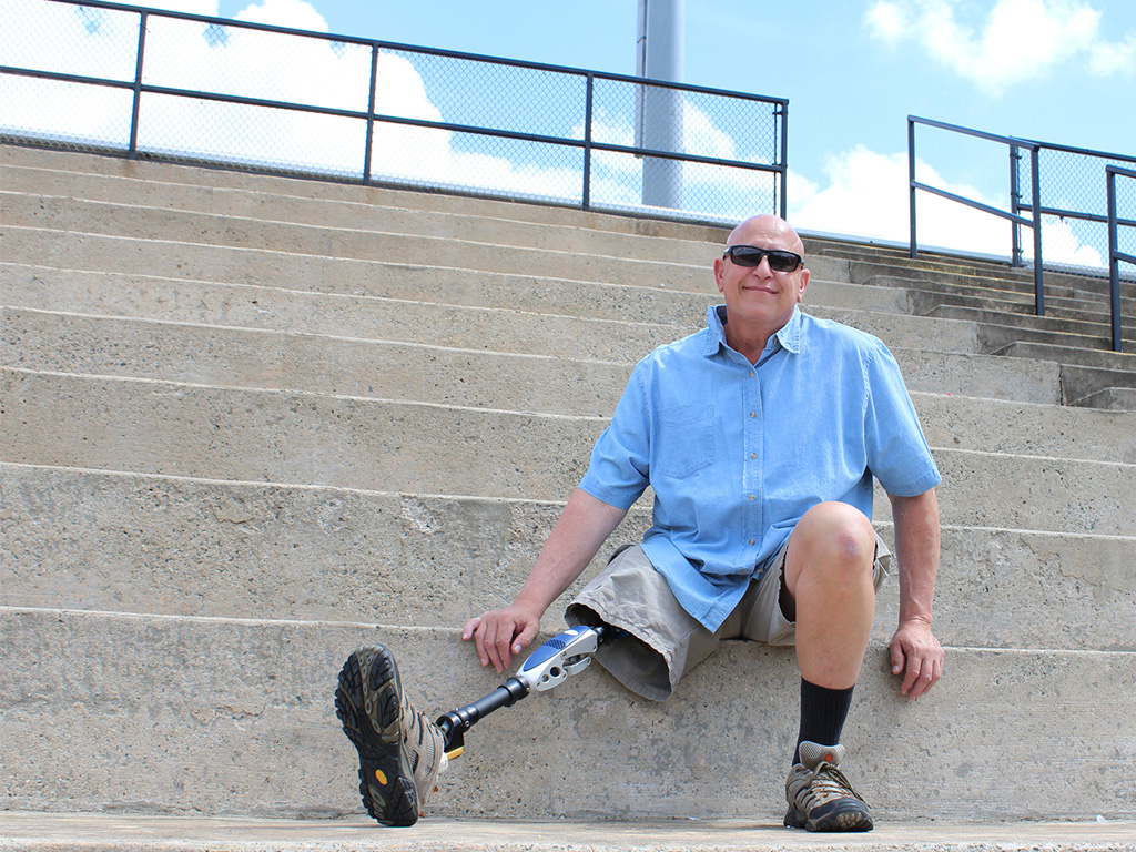 Veteran with prosthetic leg seated confidently on outdoor steps